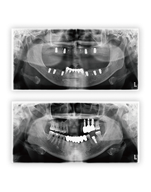 Clinical Case 이미지